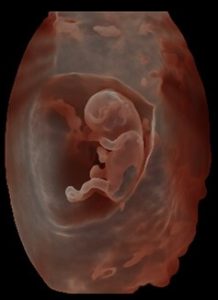 High-definition 3D ultrasound of 11 week old fetus in womb.