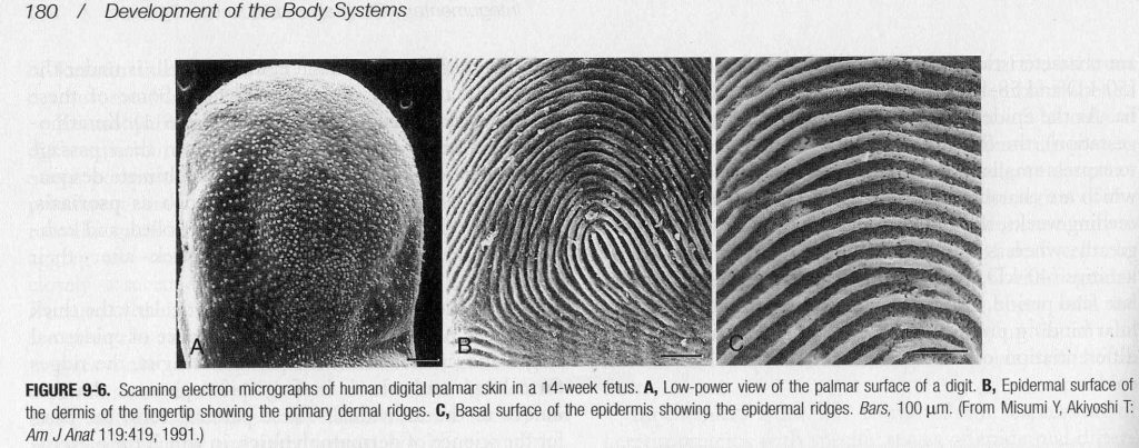 Fingerprint patterns of a 14 week old fetus